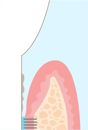 治療前