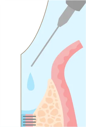 薬を投入