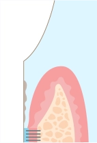治療前