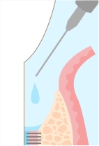 薬を投入